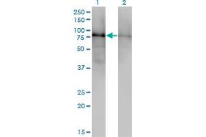 Western Blot analysis of DBR1 expression in transfected 293T cell line by DBR1 monoclonal antibody (M01), clone 3A7.