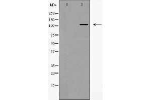 Western blot analysis of Integrin α5 (CD49e) expression in HeLa cells,The lane on the left is treated with the antigen-specific peptide. (ITGA5 抗体  (Internal Region))
