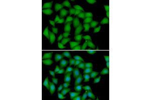 Immunofluorescence analysis of HeLa cell using ATOX1 antibody. (ATOX1 抗体)