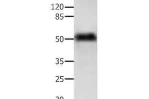 Western Blot analysis of Human lymphoma tissue using ACTG1 Polyclonal Antibody at dilution of 1:350 (Actin, gamma 1 抗体)