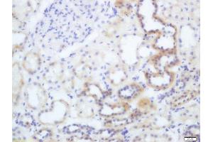 Formalin-fixed and paraffin embedded human kidney labeled with Anti-Phospho-eNOS (Thr495) Polyclonal Antibody, Unconjugated  at 1:200 followed by conjugation to the secondary antibody and DAB staining (ENOS 抗体  (pThr495))