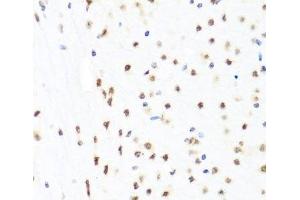 Immunohistochemistry of paraffin-embedded Mouse brain using GATA2 Polyclonal Antibody at dilution of 1:100 (40x lens). (GATA2 抗体)