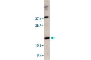 Western blot analysis of CRADD in HeLa total cell lysate with CRADD polyclonal antibody  at 1 ug/mL . (CRADD 抗体  (C-Term))