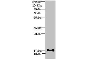 Western blot All lanes: ISCA2 antibody at 0. (ISCA2 抗体  (AA 9-154))