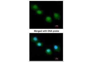 ICC/IF Image Immunofluorescence analysis of paraformaldehyde-fixed A549, using Ubiquilin-1, antibody at 1:200 dilution. (Ubiquilin 1 抗体)