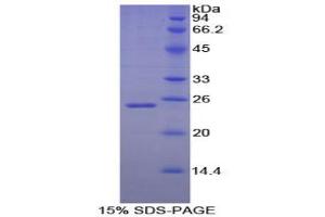 SDS-PAGE analysis of Dog Noggin Protein. (NOG 蛋白)