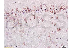 Formalin-fixed and paraffin embedded labeled with rat brain Anti-AMBRA1 Polyclonal Antibody, Unconjugated (ABIN704741) 1:200 followed by conjugation to the secondary antibody and DAB staining (AMBRA1 抗体  (AA 221-320))