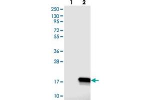 Western blot analysis of Lane 1: Negative control (vector only transfected HEK293T lysate), Lane 2: Over-expression Lysate (Co-expressed with a C-terminal myc-DDK tag (~3. (C14ORF119 抗体)