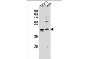 ZN Antibody (C-term) (ABIN655885 and ABIN2845286) western blot analysis in MCF-7,Hela cell line lysates (35 μg/lane). (ZNF384 抗体  (C-Term))