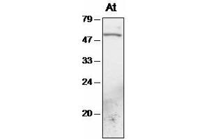 Western blot analysis of Arabidopsis chloroplast proteins with anti-TAK1 (Serine/threonine Protein Kinase (At4g02630) 抗体)