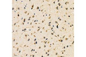 Immunohistochemistry of paraffin embedded mouse brain using ANXA3 (ABIN7073065) at dilution of 1: 200 (400x lens) (Annexin A3 抗体)