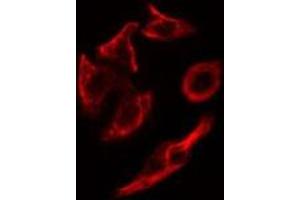 ABIN6278818 staining HepG2 cells by IF/ICC.