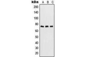 Western blot analysis of NF-kappaB p65 (pS536) expression in HeLa TNFa-treated (A), NIH3T3 LPS-treated (B), rat brain (C) whole cell lysates. (NF-kB p65 抗体  (C-Term, pSer536))