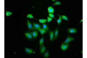 Immunofluorescence staining of Hela cells cells with ABIN7163449 at 1: 200, counter-stained with DAPI. (PIH1D1 抗体  (AA 1-290))