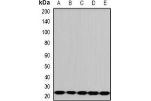 Western blot analysis of PCMT1 expression in HepG2 (A), A431 (B), mouse liver (C), rat brain (D), rat heart (E) whole cell lysates. (PCMT1 抗体)