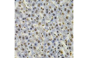 Immunohistochemistry of paraffin-embedded rat liver using IFI16 Antibody. (IFI16 抗体)