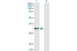 Western Blot analysis of SPR expression in transfected 293T cell line by SPR monoclonal antibody (M01), clone 4F2. (SPR 抗体  (AA 164-260))