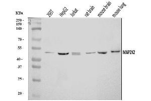 Western blot analysis of MEK2/MAP2K2 using anti-MEK2/MAP2K2 antibody (ABIN7599404).