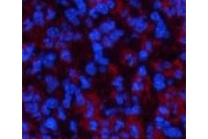 Immunofluorescence analysis of Mouse spleen tissue using ATG7 Monoclonal Antibody at dilution of 1:200.