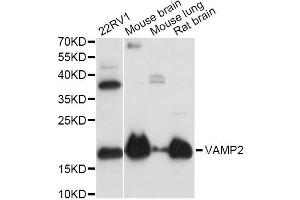 Western blot analysis of extracts of various cell lines, using VAMP2 antibody (ABIN1875306) at 1:3000 dilution. (VAMP2 抗体)