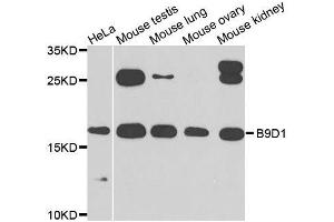 Western blot analysis of extracts of various cell lines, using B9D1 antibody.