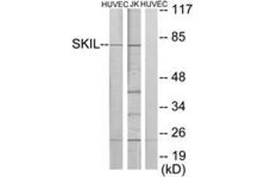 Western blot analysis of extracts from HuvEc/Jurkat cells, using SKIL Antibody. (SKIL 抗体  (AA 616-665))