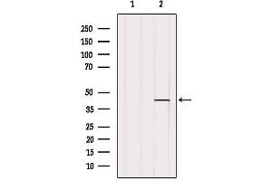 Western blot analysis of extracts from HepG2, using U12 Antibody. (RNU12-2P 抗体)