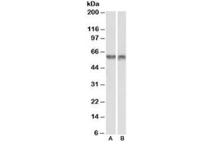 Western blot testing of nuclear mouse NIH3T3 [A] and nuclear human HeLa [B] lysates with PDCD4 antibody at 1ug/ml. (PDCD4 抗体)
