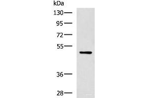 Western blot analysis of MCF-7 cell lysate using PAX2 Polyclonal Antibody at dilution of 1:400 (PAX2A 抗体)
