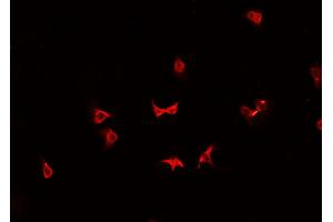 ABIN6266906 staining K-562 cells by IF/ICC. (HSPH1 抗体  (C-Term))