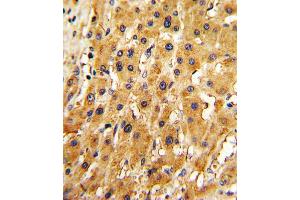 Immunohistochemistry (IHC) image for anti-Adenine Phosphoribosyltransferase (APRT) antibody (ABIN3001698) (APRT 抗体)