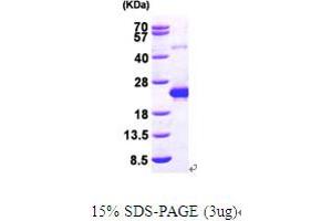 SDS-PAGE (SDS) image for DCMP Deaminase (DCTD) (AA 1-178) protein (His tag) (ABIN667034)