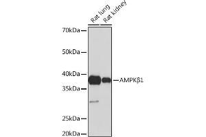 Western blot analysis of extracts of various cell lines, using AMPKβ1 Rabbit mAb (ABIN7269654) at 1:1000 dilution. (PRKAB1 抗体)