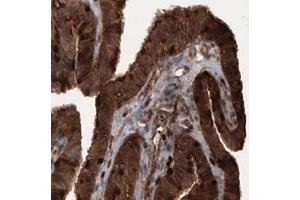 Immunohistochemical staining (Formalin-fixed paraffin-embedded sections) of human fallopian tube with PFN1 monoclonal antibody, clone CL3524  shows cytoplasmic immunoreactivity in epithelial cells. (PFN1 抗体)