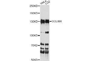 Western blot analysis of extracts of various cell lines, using GOLIM4 antibody (ABIN6291706) at 1:1000 dilution. (Golgi Integral Membrane Protein 4 (GOLIM4) 抗体)