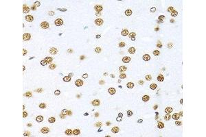 Immunohistochemistry (Paraffin-embedded Sections) (IHC (p)) image for anti-KH Domain Containing, RNA Binding, Signal Transduction Associated 1 (KHDRBS1) antibody (ABIN7261952)