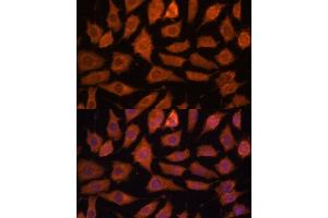 Immunofluorescence analysis of L929 cells using Legumain (Legumain (LGMN)) Polyclonal Antibody (ABIN6128201, ABIN6143172, ABIN6143173 and ABIN6214867) at dilution of 1:100 (40x lens). (LGMN 抗体  (AA 18-323))