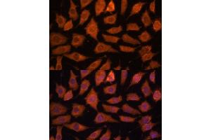 Immunofluorescence analysis of L929 cells using Legumain (Legumain (LGMN)) Polyclonal Antibody (ABIN6128201, ABIN6143172, ABIN6143173 and ABIN6214867) at dilution of 1:100 (40x lens).