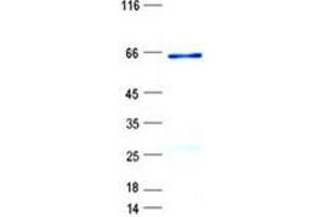 Validation with Western Blot