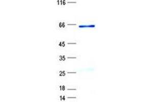 Validation with Western Blot (SFRP2 Protein (GST tag,His tag))