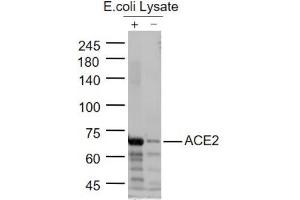 Lane 1:ACE2 Protein Overexpression E.