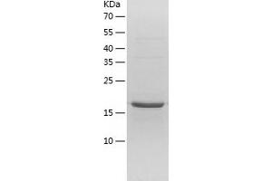 Western Blotting (WB) image for Nucleolar Protein 16 (NOP16) (AA 1-178) protein (His tag) (ABIN7124221) (NOP16 Protein (AA 1-178) (His tag))