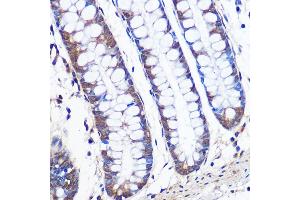Immunohistochemistry of paraffin-embedded human colon using ERK5 Rabbit mAb (ABIN1680723, ABIN3018327, ABIN3018328 and ABIN7101595) at dilution of 1:100 (40x lens). (MAPK7 抗体)