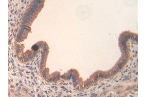 SLIT3 antibody  (AA 1348-1517)
