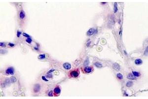 Human, Lung, Type 2 pneumocytes: Formalin-Fixed Paraffin-Embedded (FFPE) (Surfactant Protein C 抗体  (AA 144-173))