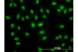 Immunofluorescence of monoclonal antibody to DDX56 on HeLa cell. (DDX56 抗体  (AA 450-547))