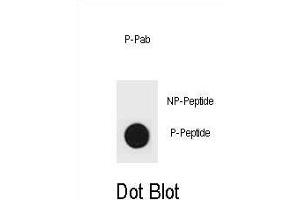 Dot blot analysis of p27Kip1 Antibody (Phospho S83) Phospho-specific Pab (ABIN1881622 and ABIN2839970) on nitrocellulose membrane. (CDKN1B 抗体  (pSer83))
