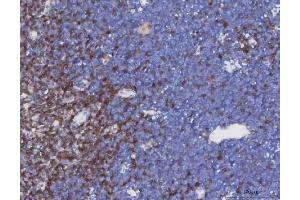 IHC analysis of TCR alpha/TRAC using anti-TCR alpha/TRAC antibody (ABIN6719654). (TRAC 抗体  (AA 1-114))