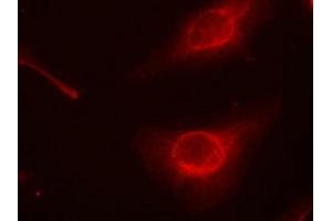 Immunofluorescence staining of methanol-fixed Hela cells using cofilin(Phospho-Ser3) Antibody. (Cofilin 抗体  (pSer3))