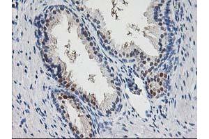 Immunohistochemical staining of paraffin-embedded Human prostate tissue using anti-PNMT mouse monoclonal antibody. (PNMT 抗体)
